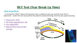 tear function test|tear breakup time test.